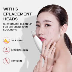 Rechargeable Blackheads Acne Removal Nose Cleanser