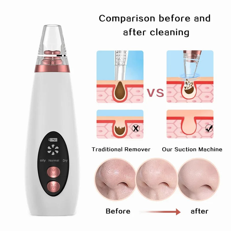 Rechargeable Blackheads Acne Removal Nose Cleanser