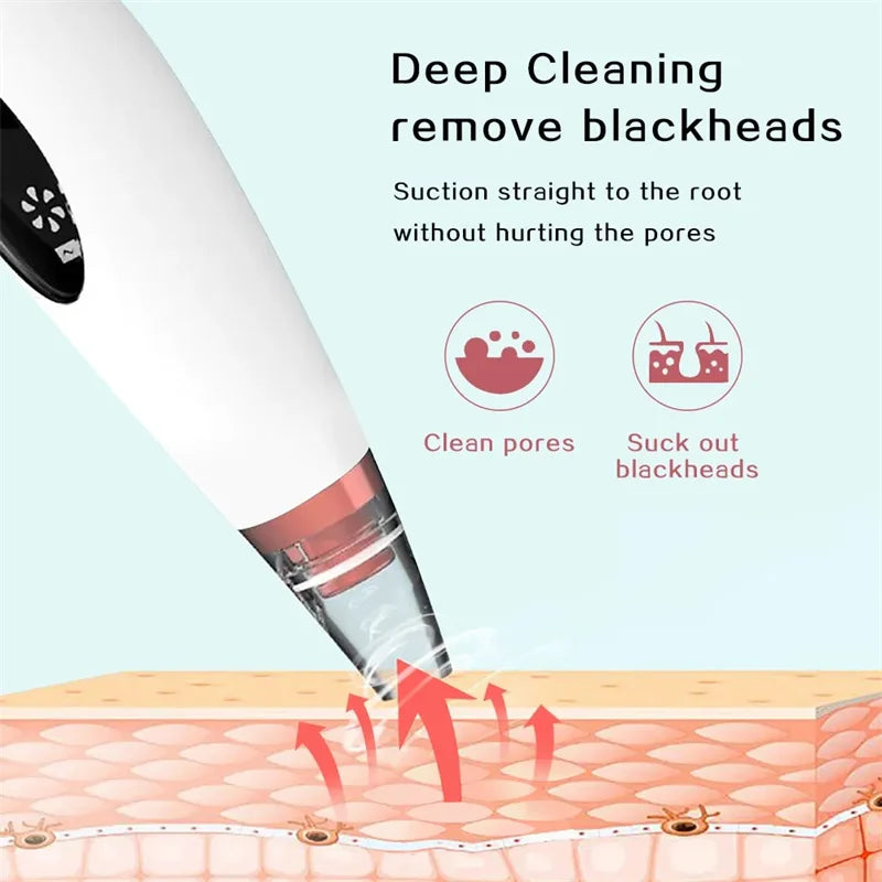 Rechargeable Blackheads Acne Removal Nose Cleanser